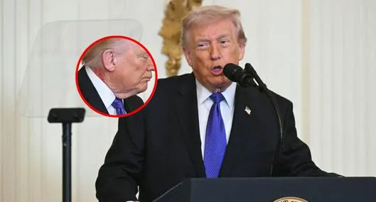 Donald Trump y la mancha roja en el cuello: explicación oficial de Casa Blanca