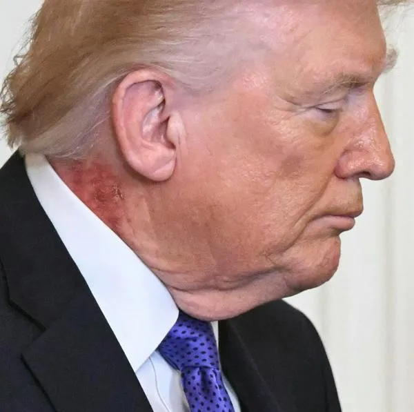 Donald Trump, presidente de Estados Unidos, con una mancha roja en el cuello