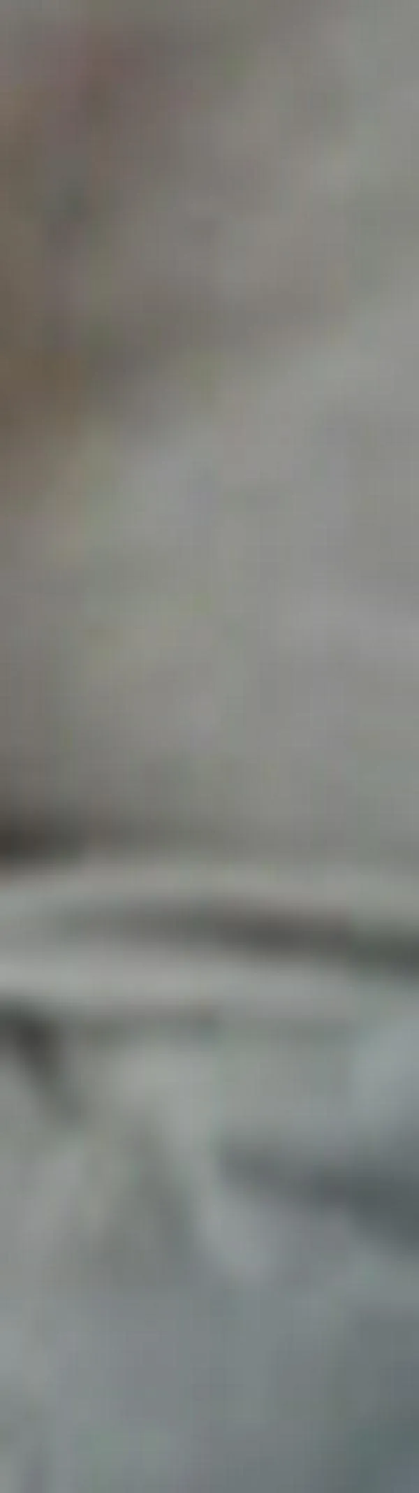 Uno de cada diez adultos vive con enfermedad renal crónica