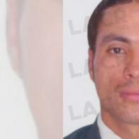 Investigan muerte de hombre tras ingreso al hospital por golpe en la cabeza