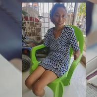 En Barranquilla, mujer fue al hospital por fiebre y le amputaron extremidades