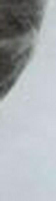 Incautan base de coca en prótesis simulada