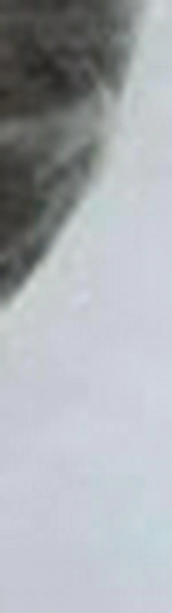 Incautan base de coca en prótesis simulada