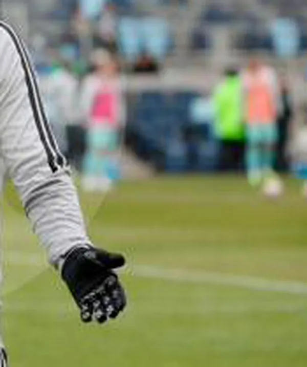 James Rodríguez tiene historial de 40 lesiones y su equipo dice que “es grave”