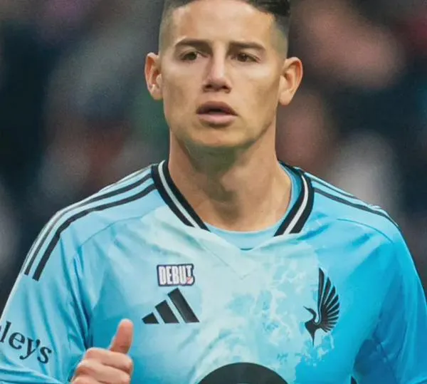 DT de Minessota sobre James Rodríguez; "lo integraremos cuando los médicos lo vean adecuado"