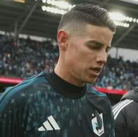 "En el Minnesota no pueden hablar más de la cuenta de la salud de James Rodríguez, se viola la ley"