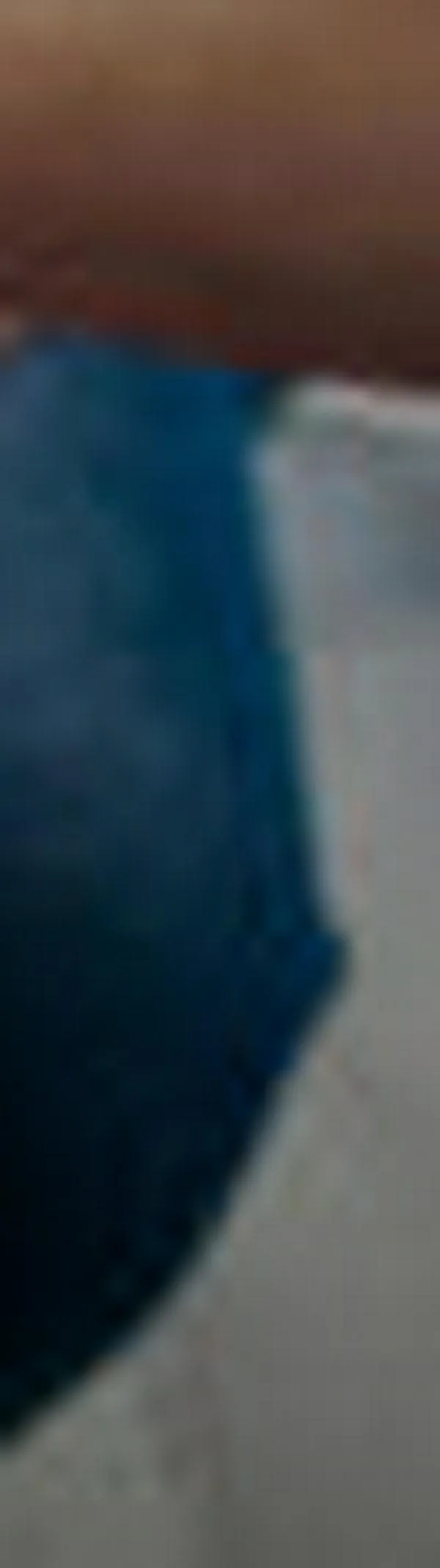 Cintas kinesiológicas: beneficios a corto plazo limitados y riesgo de irritación cutánea