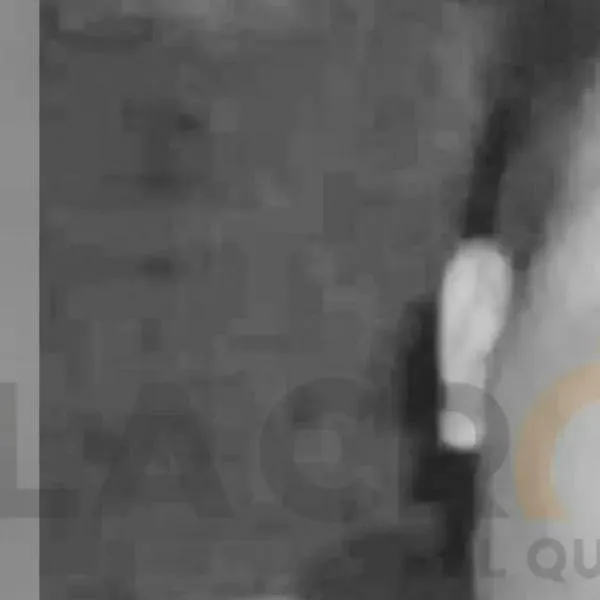 Murió extranjero que había sufrido un accidente laboral