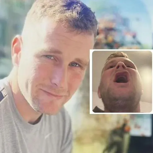 Hombre buscó ahorro para mejorar su sonrisa y acabó sin dientes por mala cirugía