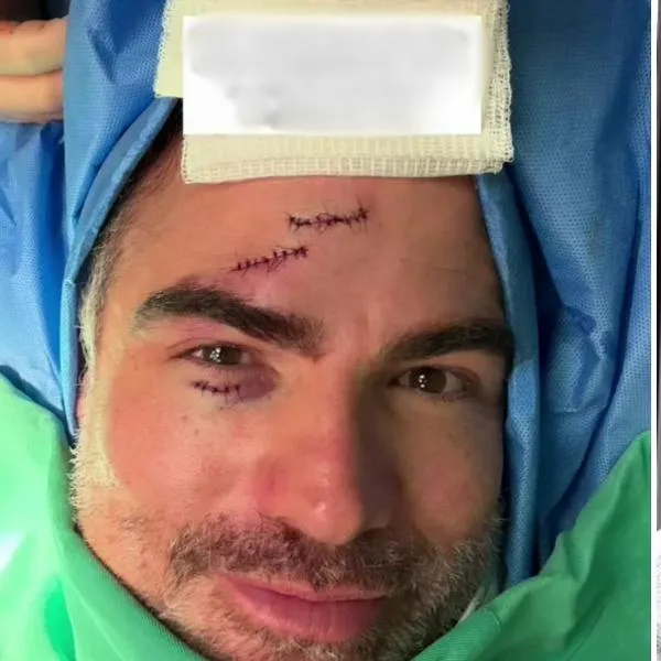 Reconocido actor de ‘Sin senos sí hay paraíso’ sufrió un accidente en medio de una escena