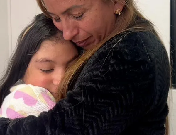 Subred Norte de Salud logró exitoso injerto capilar en niña tras grave accidente en Bogotá 