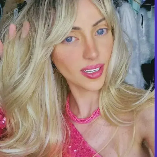 Murió La Barbie humana: hay dos hipótesis y una de ella apunta a un homicidio