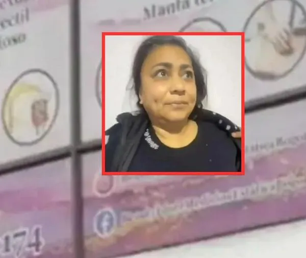 De qué murió Yulixa Toloza: Medicina Legal revela la causa de su muerte