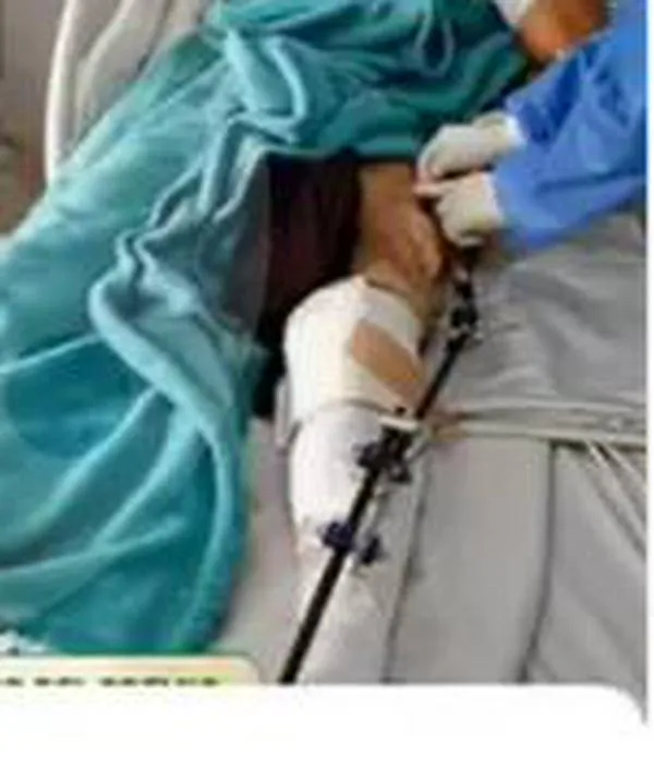 Negligencia en el sistema de salud llevó a la CIDH a intervenir por joven en riesgo de amputación