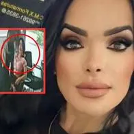 Influencer murió en Brasil después de cirugía estética de más de $ 35 millones