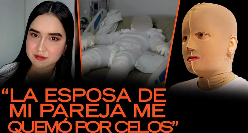 imagen nota lateral