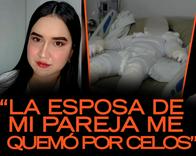 Habló mujer a la que le prendieron fuego por celos y pide justicia: cómo pasó 