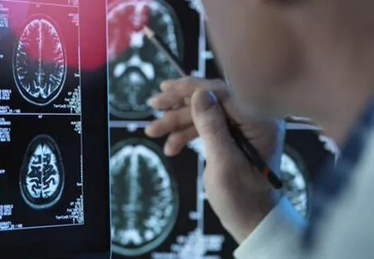 ¿El cerebro cambia de “interruptor” cuando hablamos otro idioma? Un estudio da nuevas pistas