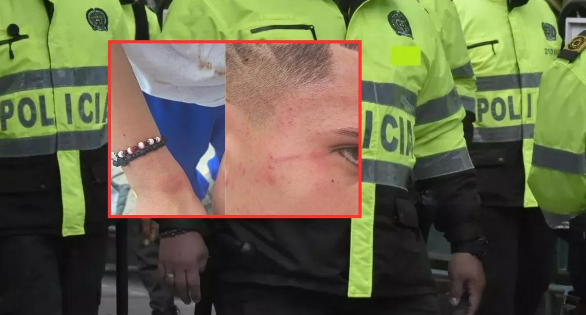 Denuncian presunto abuso policial en Bogotá: menor de edad habría sido agredido