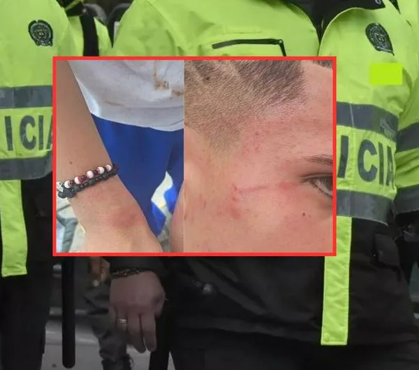 Denuncian presunto abuso policial en Bogotá: menor de edad habría sido agredido