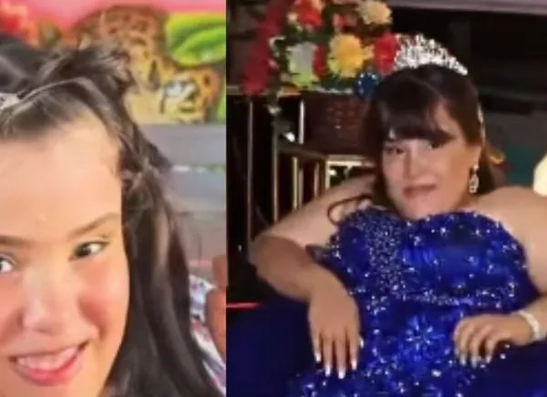 Joven ibaguereña pide ayuda para continuar tratamiento en Bogotá