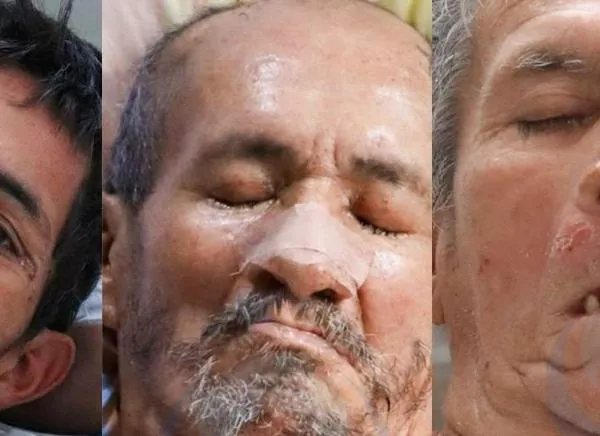 Buscan a los familiares de tres pacientes en hospital de Ibagué
