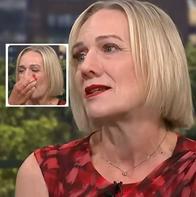 Así es Jayne Hardman, mujer con varias prótesis de nariz y qué le pasa con gripa