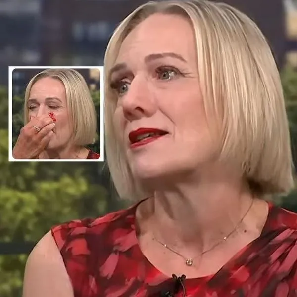 Así es Jayne Hardman, mujer con varias prótesis de nariz y qué le pasa con gripa
