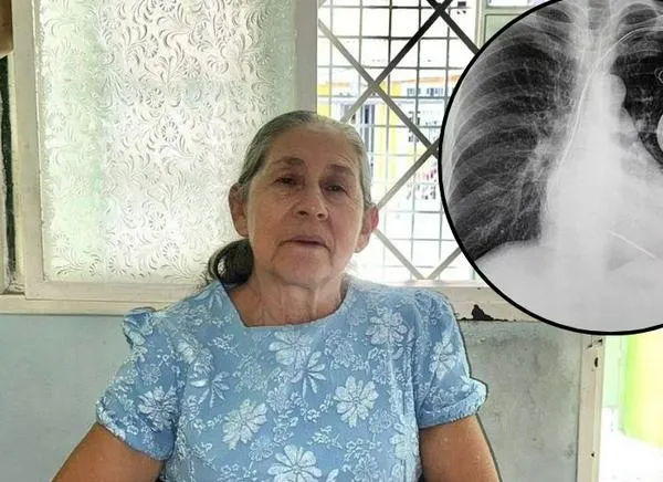 “No me quiero morir”: adulta mayor clama por su marcapasos en el Tolima