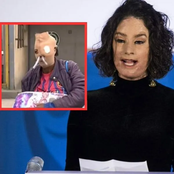 Natalia Ponce habló de drástica decisión que tomó mujer que quiere eutanasia