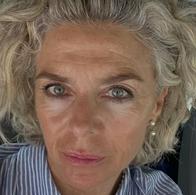 Margarita Rosa de Francisco tuvo procedimiento estético en rostro: antes y ahora