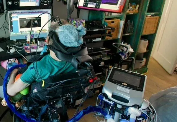 Un implante cerebral permite a personas con parálisis hablar y gesticular a la vez