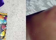 ¡Susto en Ibagué! Lata salió disparada y golpeó a una mujer en plena calle