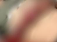 Conductor de Uber habría sido agredido “a machete” por un taxista en Ibagué