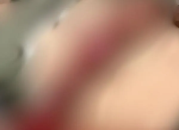 Conductor de Uber habría sido agredido “a machete” por un taxista en Ibagué