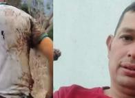 Tragedia tras los incendios: Murió hombre herido en Tolima
