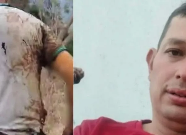 Tragedia tras los incendios: Murió hombre herido en Tolima