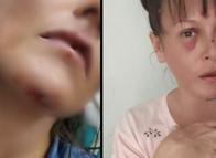 Escapaba de su acosador obsesivo y terminó accidentada en Ibagué