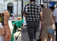 Dos abuelitos resultaron heridos tras violento atraco en el centro de Ibagué