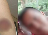 Años de violencia y acoso incesante: el drama de una mujer en Ibagué