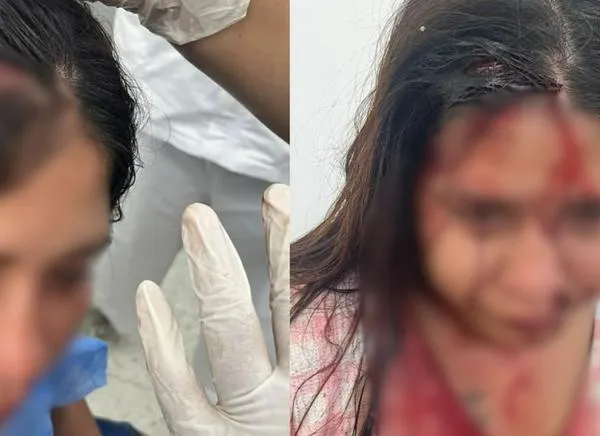 “Quiero justicia”. Mujer denuncia brutal agresión en el Tolima