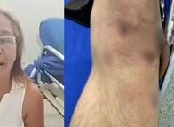 Madre denuncia presunta “tortura” contra su hijo en Estacion de Policía del Tolima