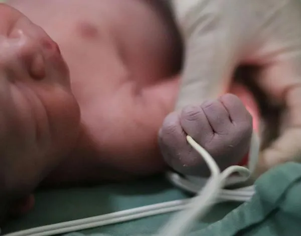 Bebé de 5 meses casi muere por golpe en la cabeza: su padre fue capturado