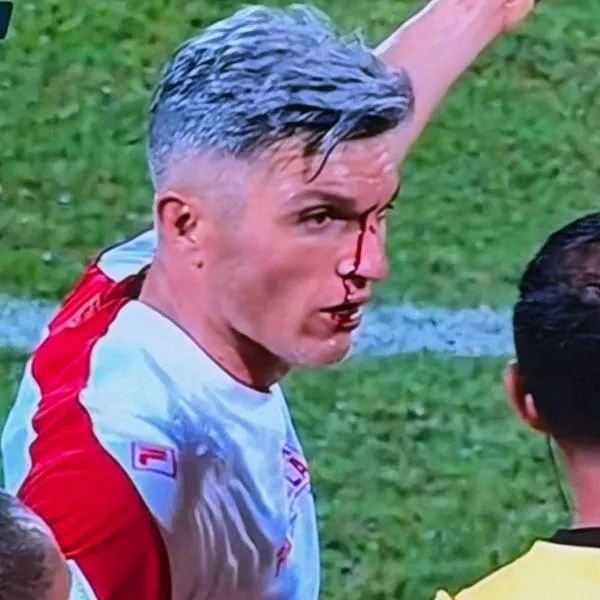 Ataque a Daniel Torres en Medellín vs Santa Fe; le lanzaron moneda y sangró