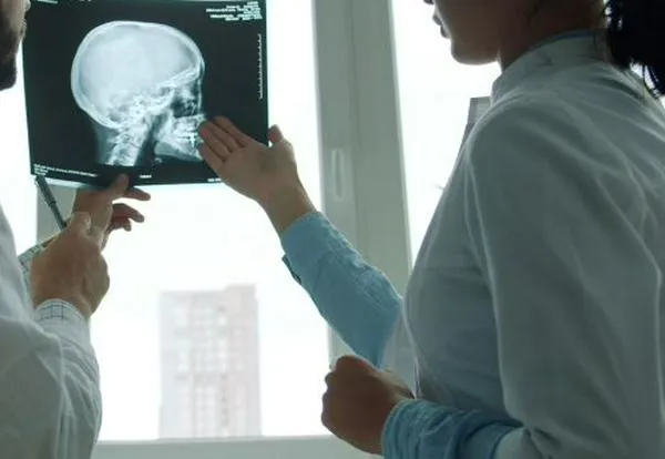 Video | ¿Qué es la parálisis cerebral? Todo lo que debe saber sobre este trastorno neurológico