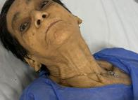 Abuelita fue hallada desorientada y buscan a sus familiares en Ibagué