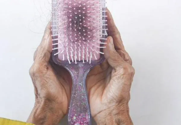 Causas de la alopecia y cómo tratarla: Guía para prevenir y mejorar la salud capilar