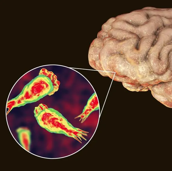 Murió menor de 10 años tras infección causada por ameba “comecerebros”