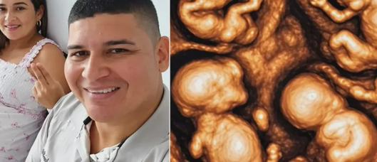 Nacen en Medellín cuatro bebés que podrían ser los primeros cuatrillizos genéticamente idénticos en Colombia