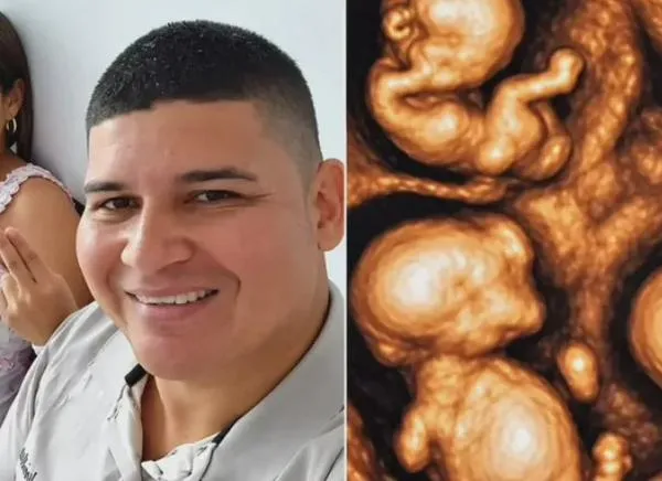 ¡Un caso extraordinario! Nacieron cuatrillizos idénticos en Colombia